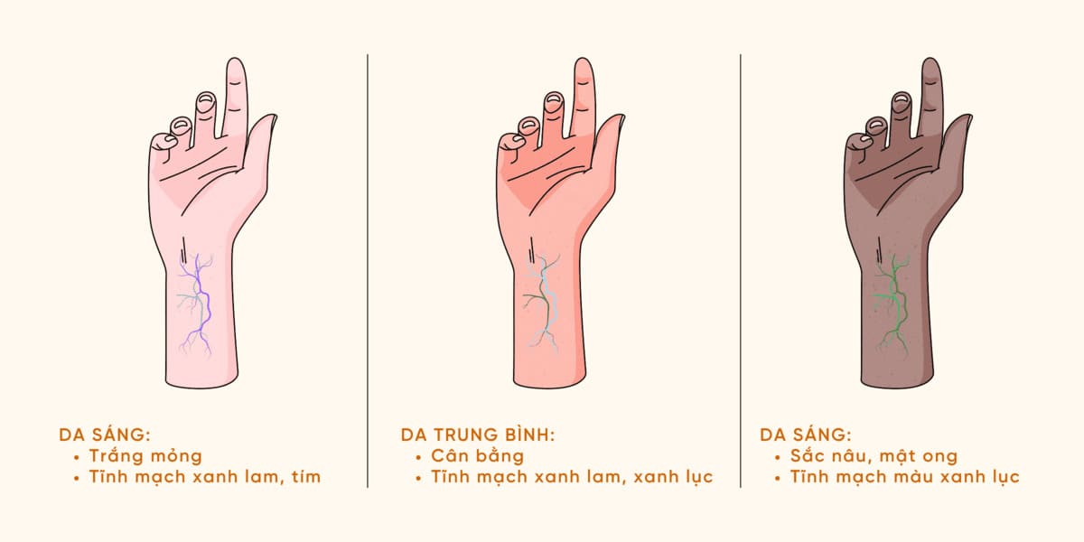 Xác định đúng nhóm da giúp bạn chọn được chất liệu kim loại phù hợp